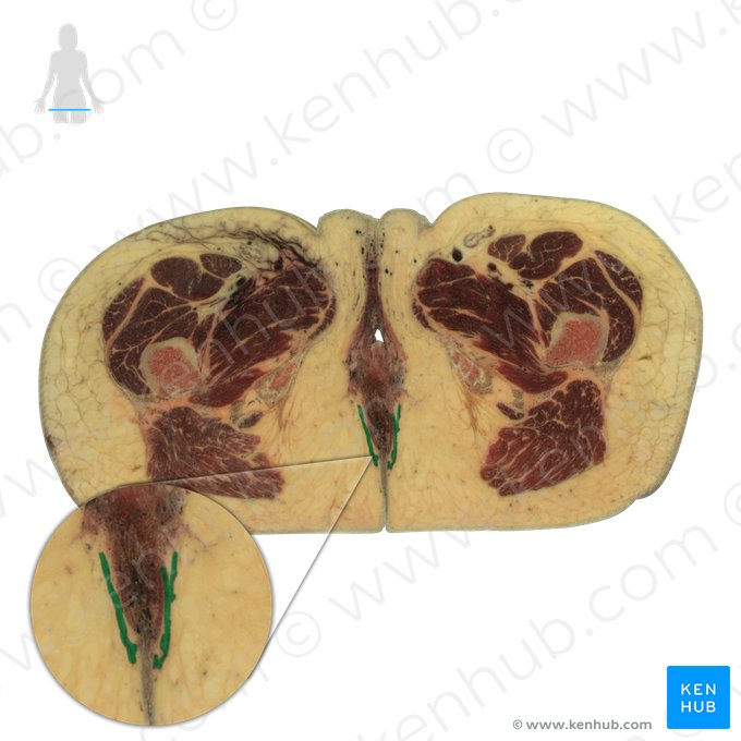 External anal sphincter (Musculus sphincter externus ani); Image: National Library of Medicine