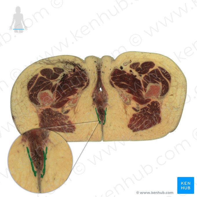 Músculo esfíncter externo do ânus (Musculus sphincter externus ani); Imagem: National Library of Medicine