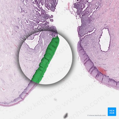 Epitélio escamoso estratificado não queratinizado (Epithelium stratificatum squamosum non cornificatum); Imagem: 