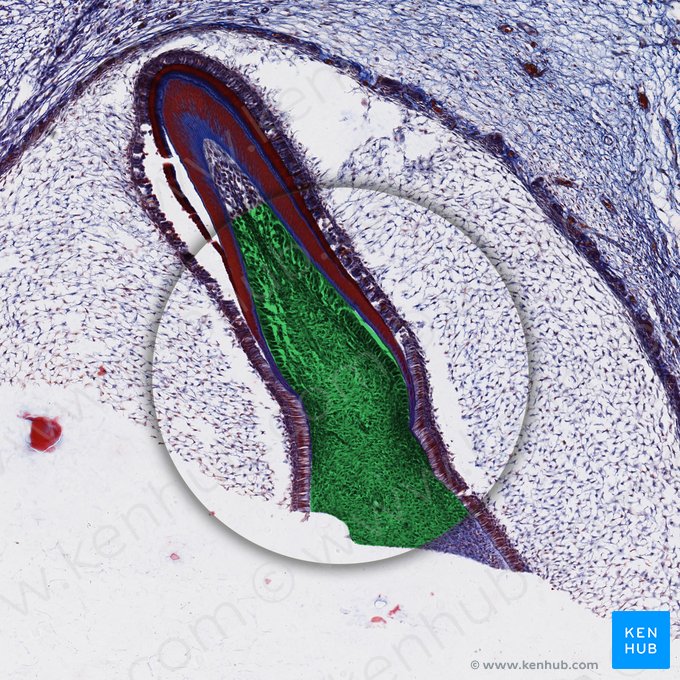 Mucoid connective tissue; Image: 