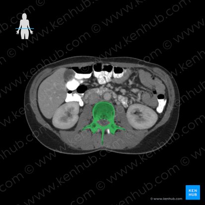 Vértebra L3 (Vertebra L3); Imagen: 