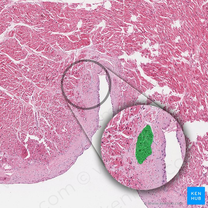 Fibres de Purkinje (Neurofibrae purkinjensia); Image : 