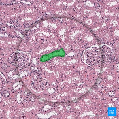 Pars convoluta tubuli proximalis (Gewundener Teil des proximalen Tubulus); Bild: 