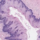 Esophagus histology