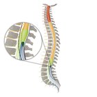 Conus medullaris und Cauda equina