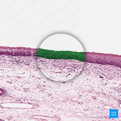 Epitelio escamoso estratificado no queratinizado (Epithelium stratificatum squamosum non cornificatum); Imagen: 