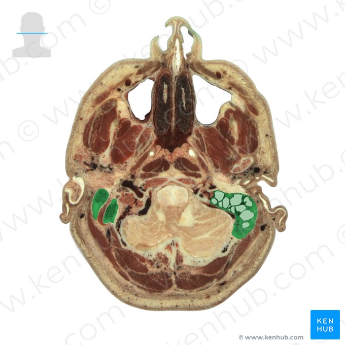 Mastoid process of temporal bone (Processus mastoideus ossis temporalis); Image: National Library of Medicine