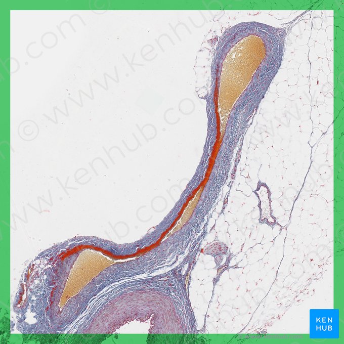 Medium vein (Vena media); Image: 