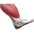 Radial tuberosity