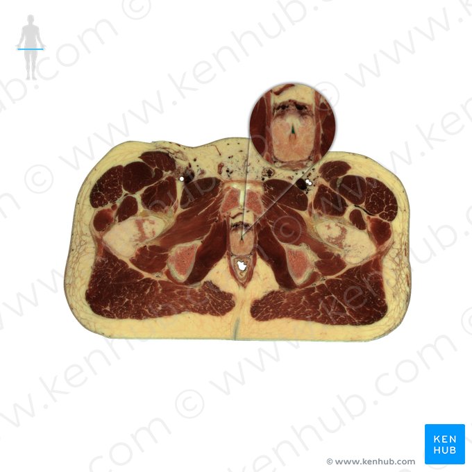 Uretra (Urethra); Imagem: National Library of Medicine