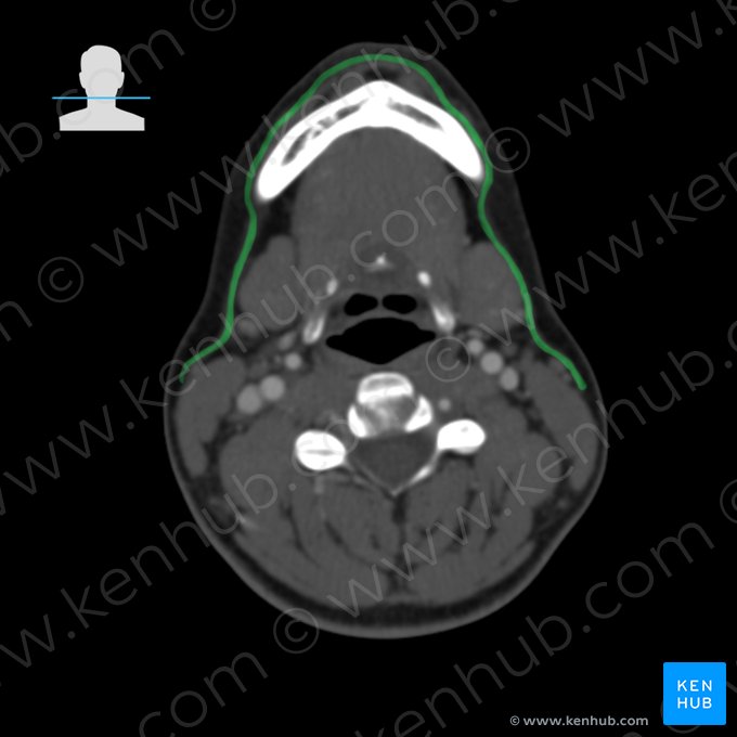 Músculo platisma (Musculus platysma); Imagen: 