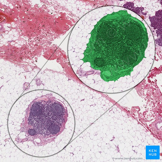 Ganglios linfáticos peripancreáticos (Nodus lymphoideus peripancreaticus); Imagen: 