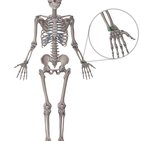 Distal radioulnar joint