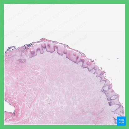 Tongue (Lingua); Image: 