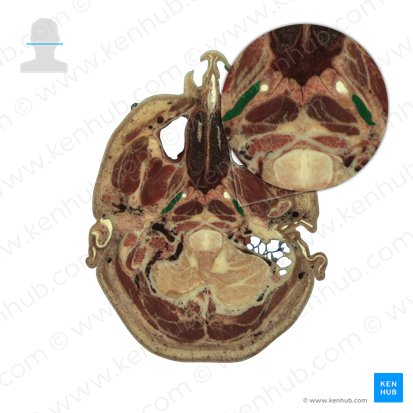 Levator veli palatini (Musculus levator veli palatini); Image: National Library of Medicine