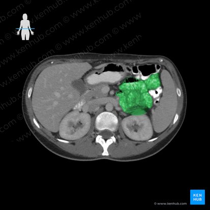 Jejunum (Leerdarm); Bild: 