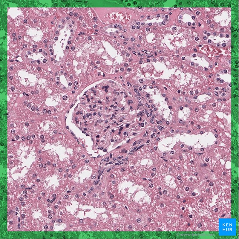 Renal corpuscle - Histological slide (H&E)