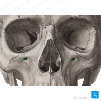 Foramen infraorbitale maxillae (Unteraugenhöhlenloch); Bild: Yousun Koh