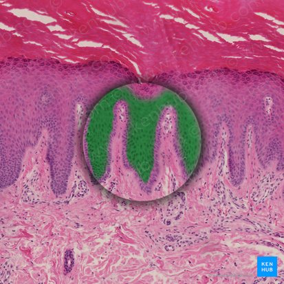 Stratum spinosum epidermis (Stachelzellschicht der Epidermis); Bild: 