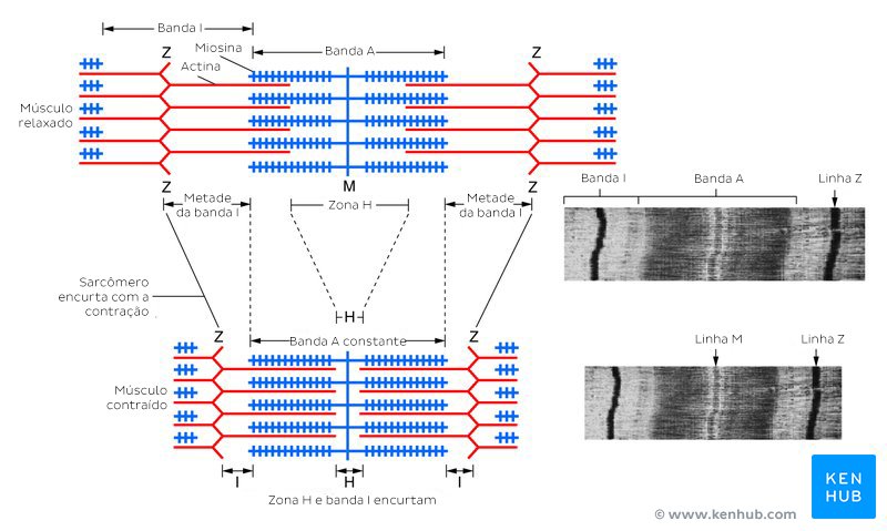 Sarcômero do músculo esquelético