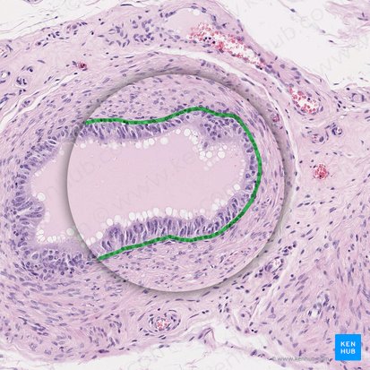 Miofibroblastos (Myofibroblasti); Imagem: 
