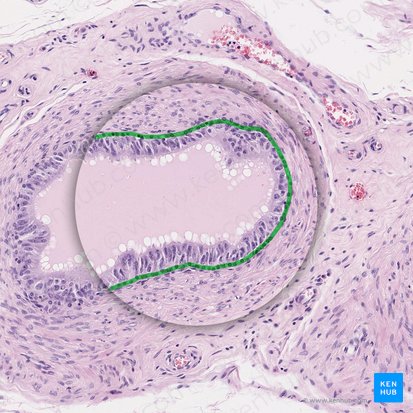 Miofibroblastos (Myofibroblasti); Imagen: 