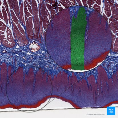 Epitelio escamoso estratificado no queratinizado (Epithelium stratificatum squamosum non cornificatum); Imagen: 