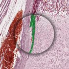 Histología del cartílago y tejido óseo