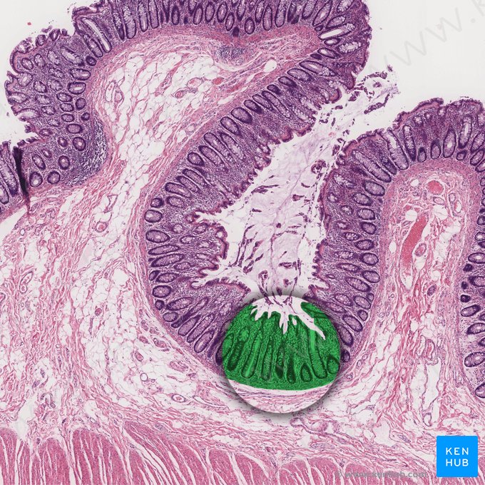 Mucosa (Tunica mucosa); Imagem: 