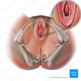 Abertura da glândula vestibular maior (Ostium glandulae vestibularis majoris); Imagem: Paul Kim