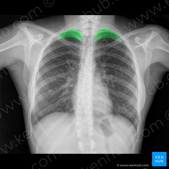 Apex of lung (Apex pulmonis); Image: 