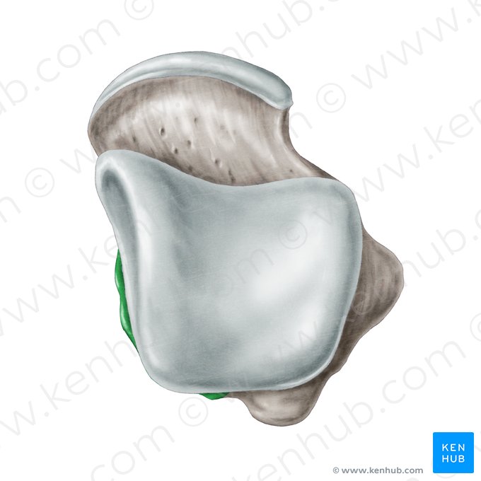 Tuberculum mediale processus posterioris ossis tali (Innerer Höcker des hinteren Sprungbeinfortsatzes); Bild: Samantha Zimmerman