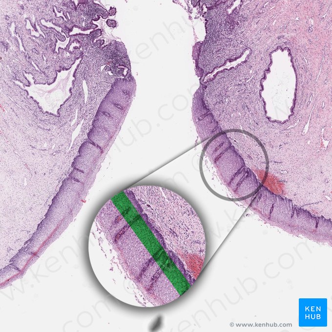 Parabasal cell layer of squamous epithelium; Image: 