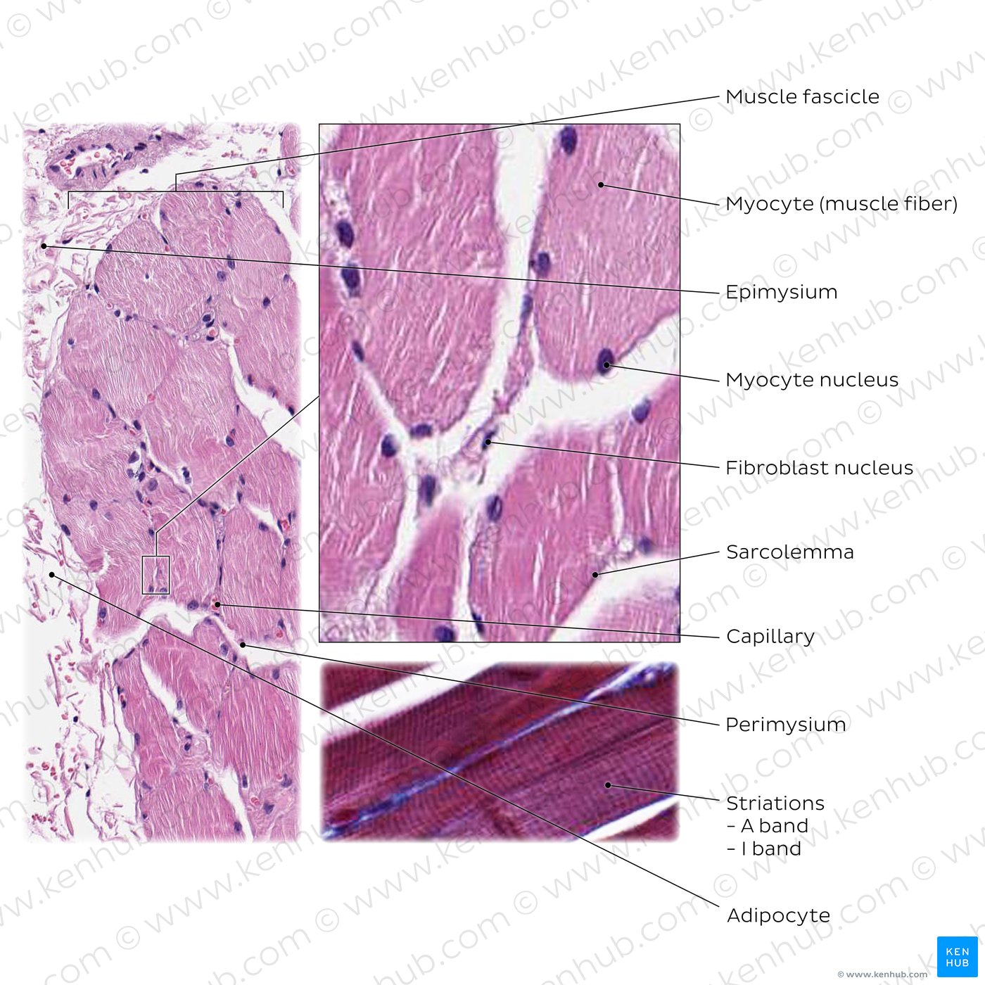 Skeletal muscle tissue