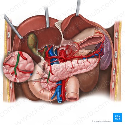 Arteria pancreaticoduodenalis superior anterior (Vordere obere Bauchspeicheldrüsen-Zwölffingerdarm-Arterie); Bild: Esther Gollan