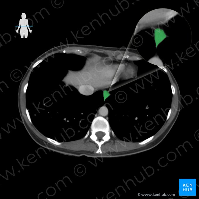 Esôfago (Oesophagus); Imagem: 