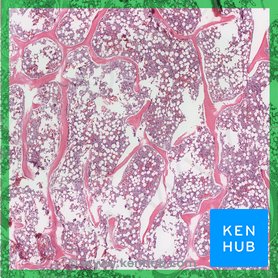 Bone Structure Anatomy And Physiology I