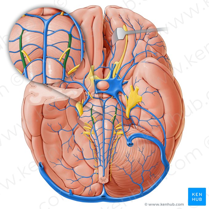 Anterolateral pontine vein (Vena anterolateralis pontis); Image: Paul Kim