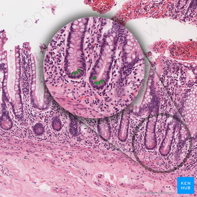 Paneth cell (Cellula panethensis); Image: 