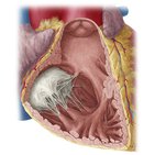 Right ventricle