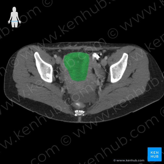 Uterus; Image: 