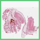 Funiculus spermaticus - Histologie
