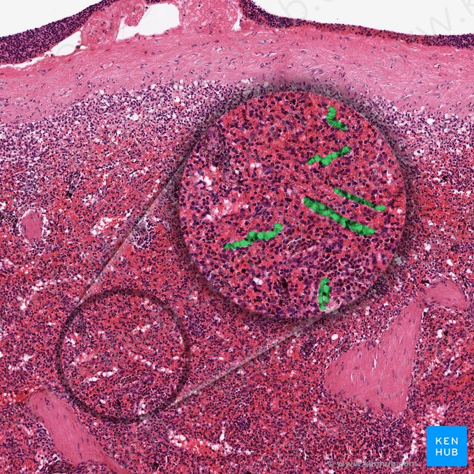 Splenic sinusoids (Vas sinusoideum splenicum); Image: 