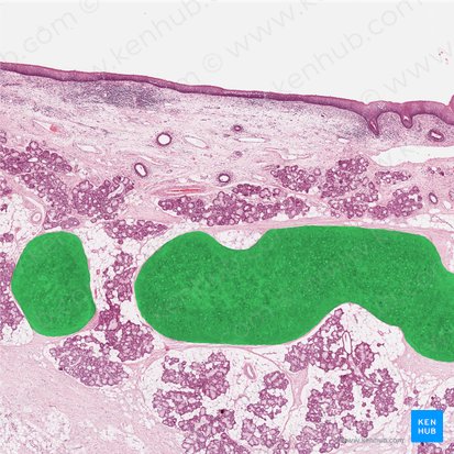 Elastic cartilage (Cartilago elastica); Image: 