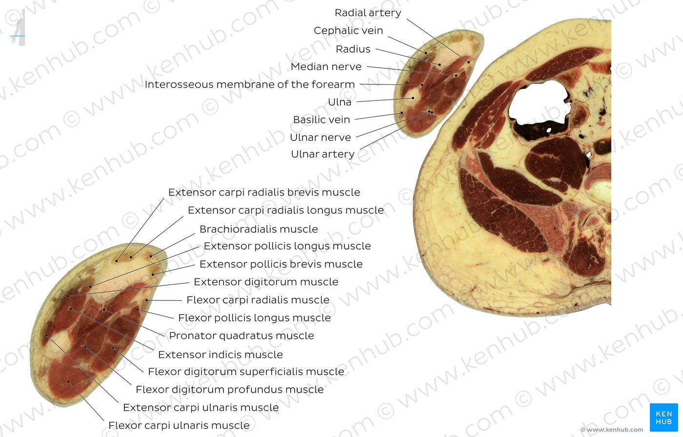 Pronator quadratus muscle level: Overview