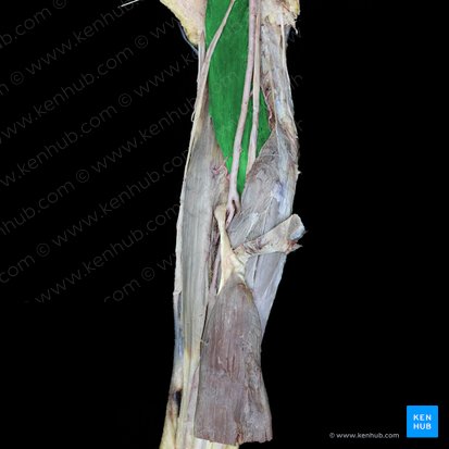 Musculus brachialis (Oberarmmuskel); Bild: 