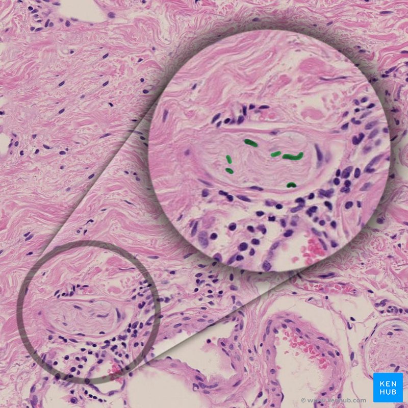 Schwann cell - histological slide
