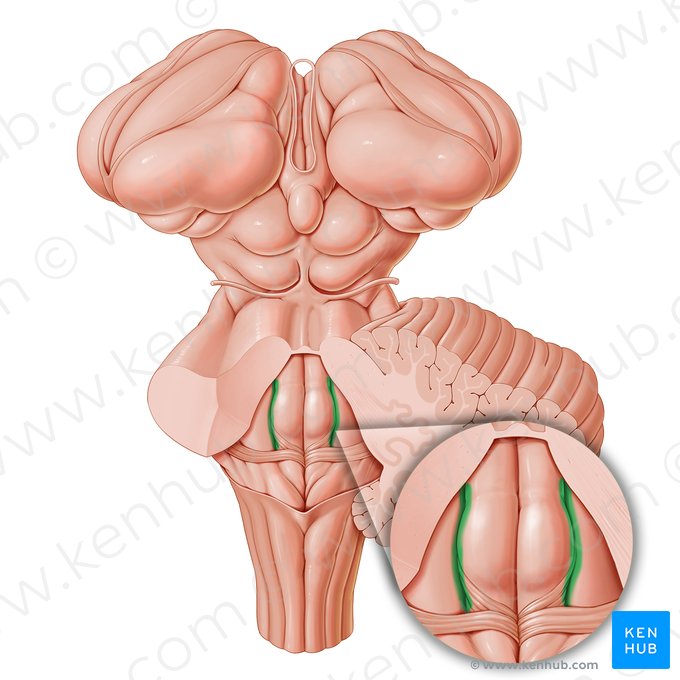 Sulcus limitans of rhomboid fossa (Sulcus limitans fossae rhomboideae); Image: Paul Kim