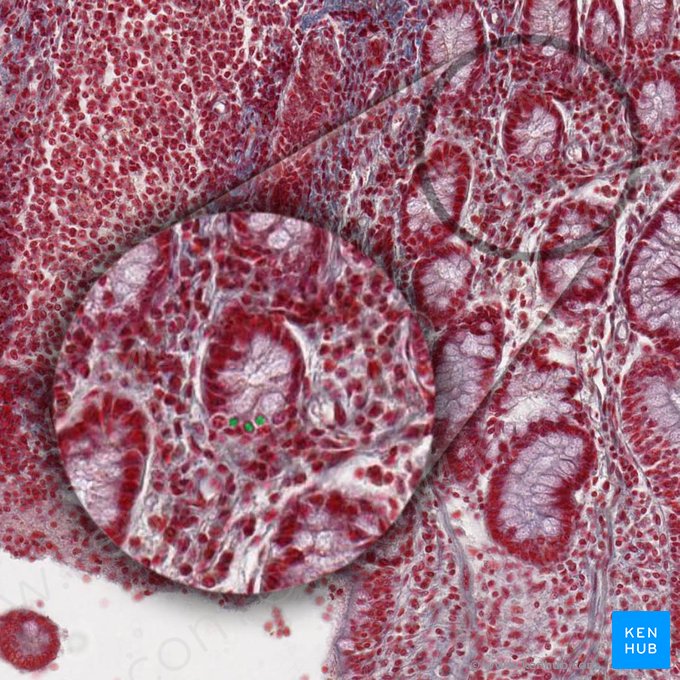Cellula APUD (APUD-Zelle); Bild: 