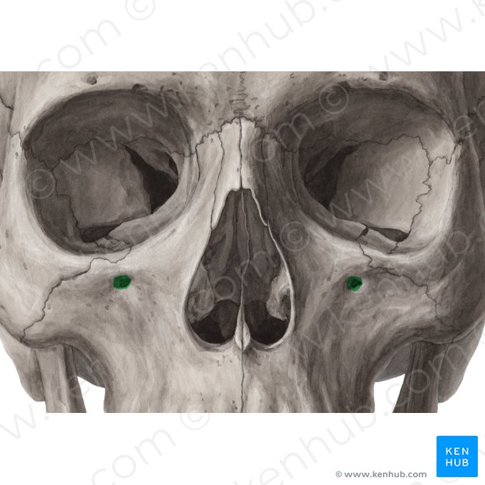 Infraorbital foramen of maxilla (Foramen infraorbitale maxillae); Image: Yousun Koh